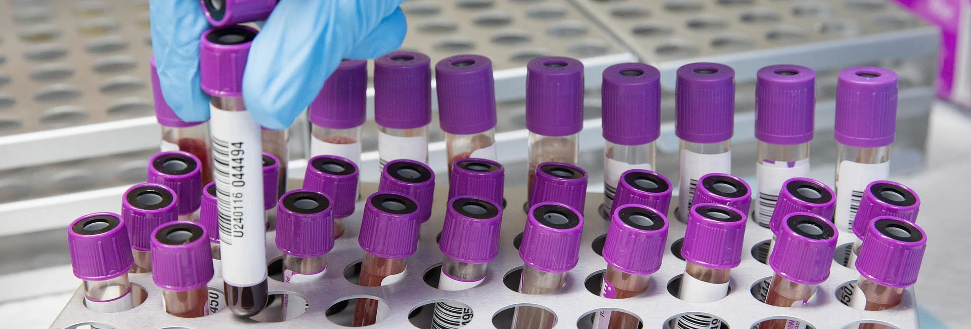 Providing the best laboratory services in Uganda