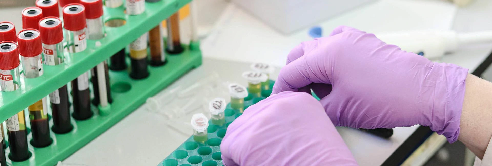 Providing the best laboratory services in Uganda