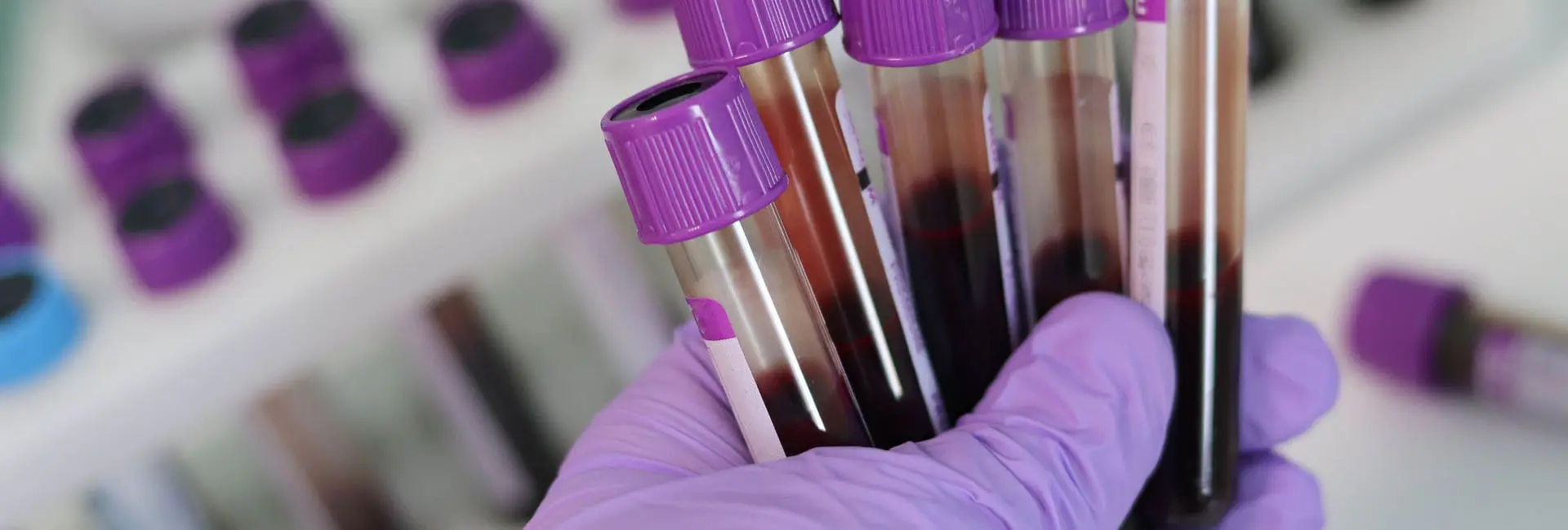 Providing the best laboratory services in Uganda